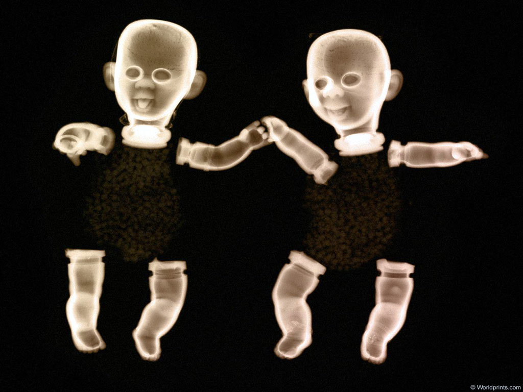XRAY_21