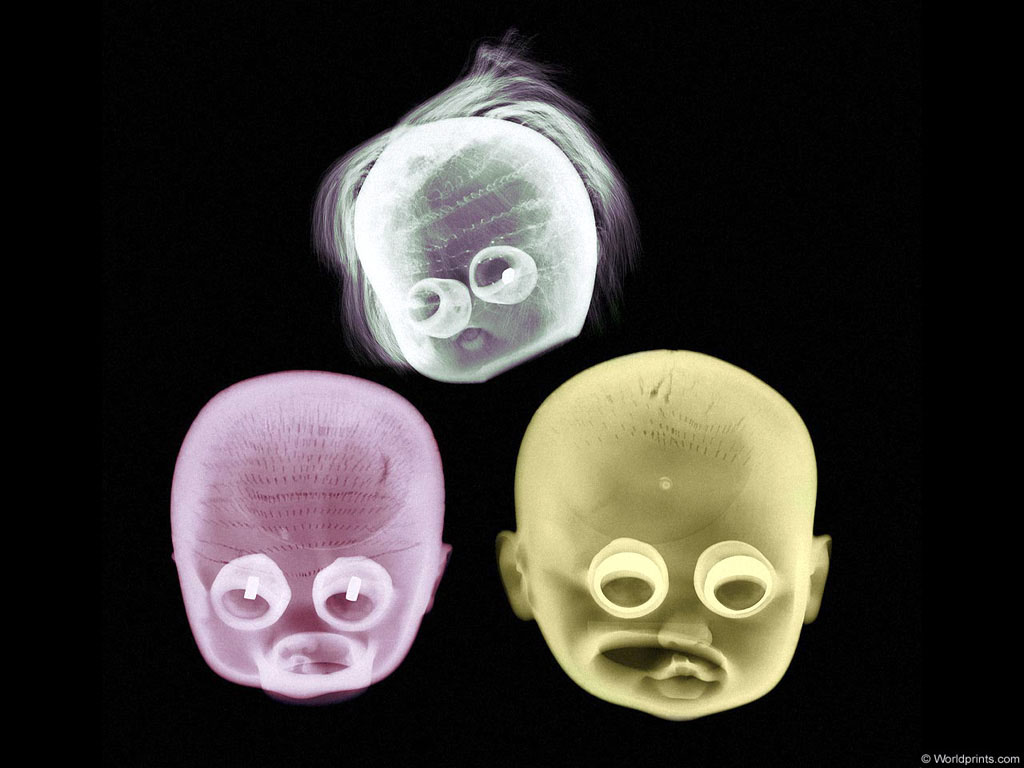 XRAY_31
