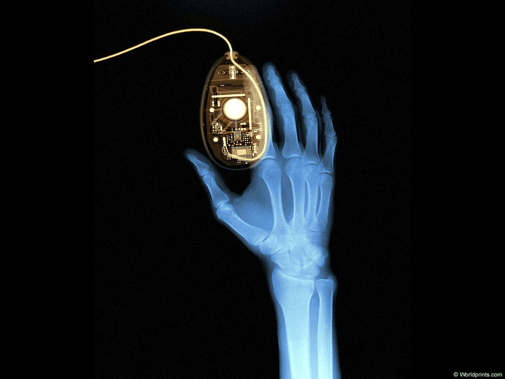 XRAY_H1