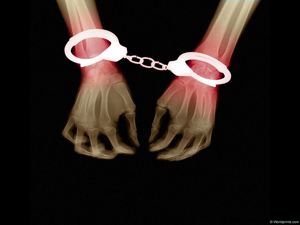 XRAY_H3