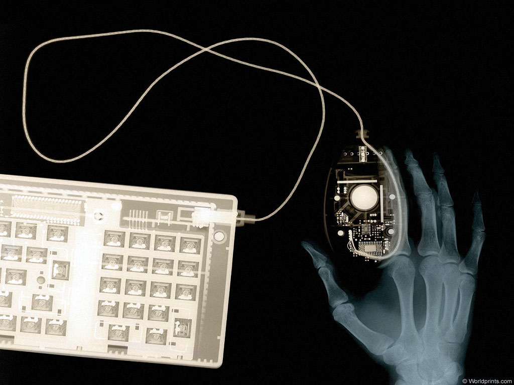 XRAY_K1