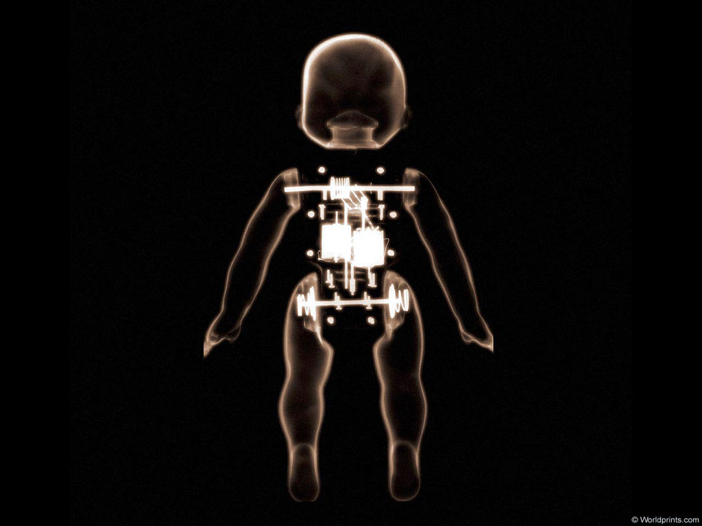 XRAY_M2