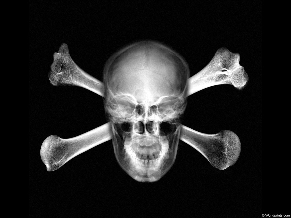 XRAY_S2