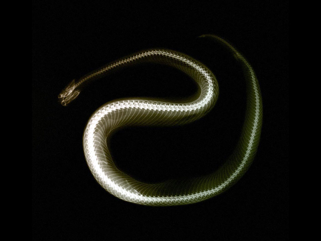 xray_snake