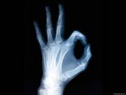 XRAY_H2