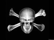 XRAY_S2