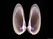 xray_clamshell